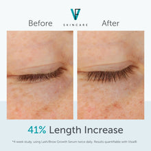 Load image into Gallery viewer, Factor Five Lash/Brow Growth Serum
